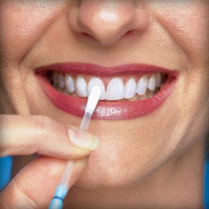 Белоснежная улыбка - результат отбеливания зубов