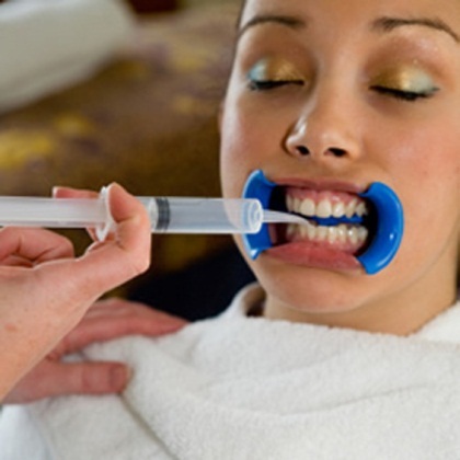 Чем отличается домашнее отбеливание зубов от профессионального отбеливания зубов