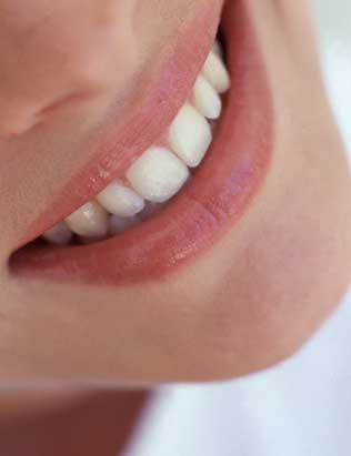 Исправление дефектов центральных зубов