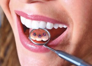 Изготовление искусственного зуба на ортодонтической пластинке