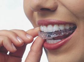 Как убрать промежутки между зубами